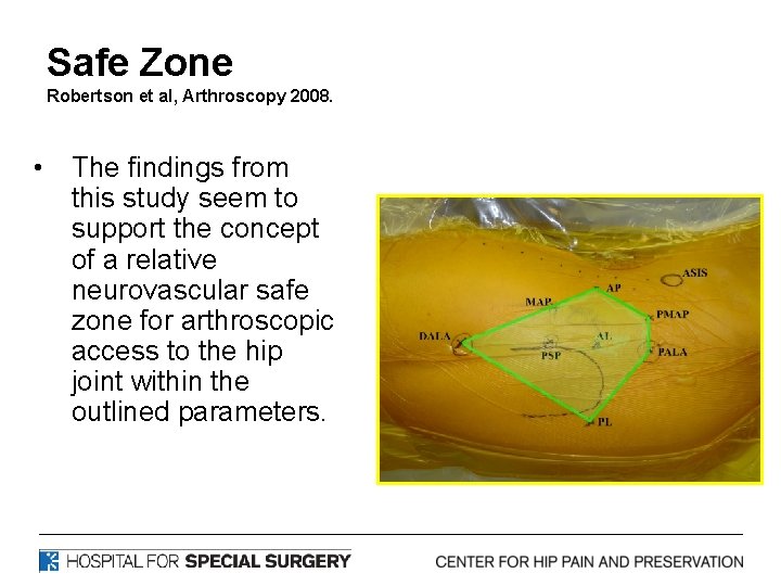 Safe Zone Robertson et al, Arthroscopy 2008. • The findings from this study seem