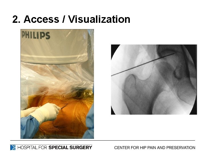 2. Access / Visualization 