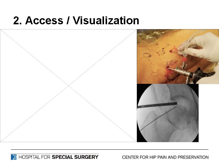 2. Access / Visualization 