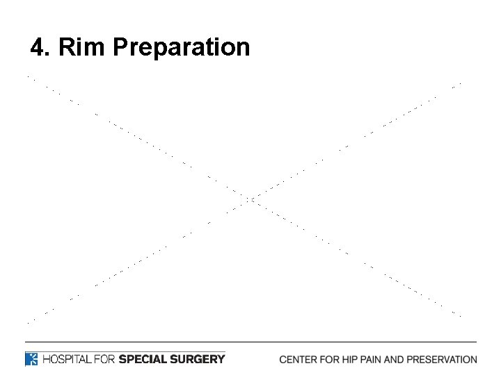 4. Rim Preparation 