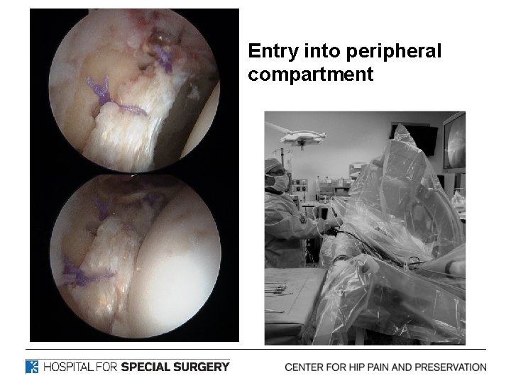 Entry into peripheral compartment 