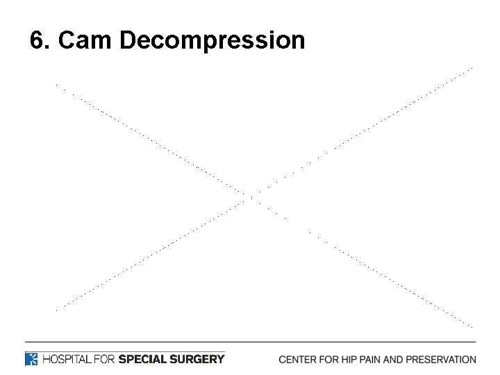 6. Cam Decompression 