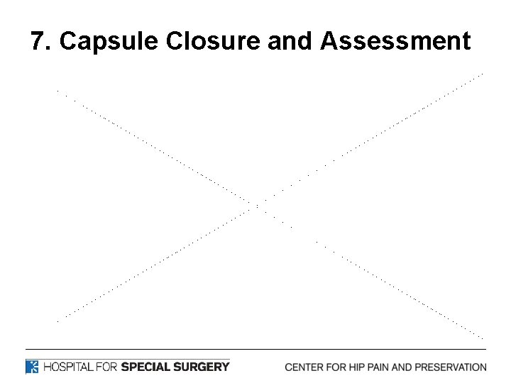 7. Capsule Closure and Assessment 