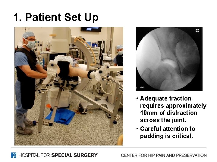 1. Patient Set Up • Adequate traction requires approximately 10 mm of distraction across