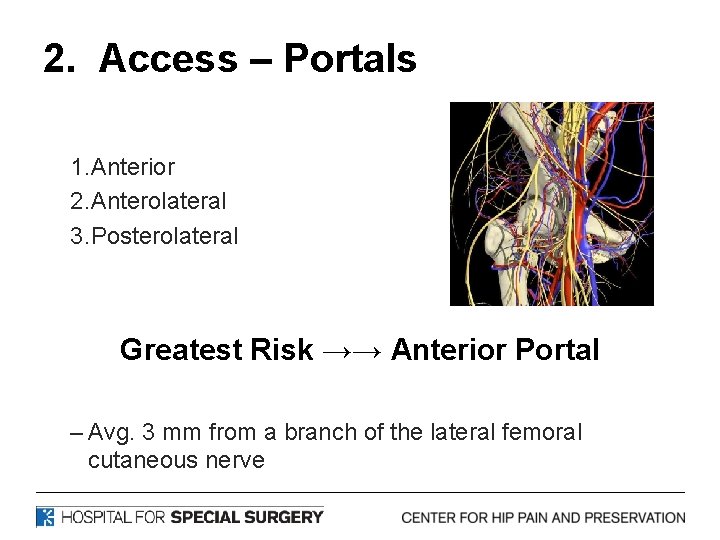 2. Access – Portals 1. Anterior 2. Anterolateral 3. Posterolateral Greatest Risk →→ Anterior