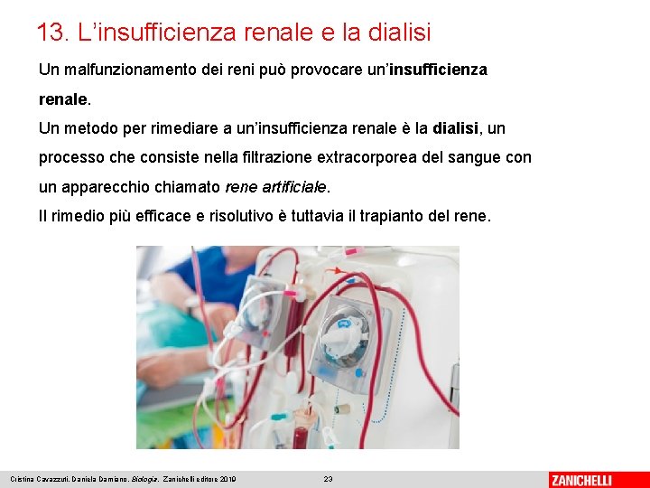 13. L’insufficienza renale e la dialisi Un malfunzionamento dei reni può provocare un’insufficienza renale.