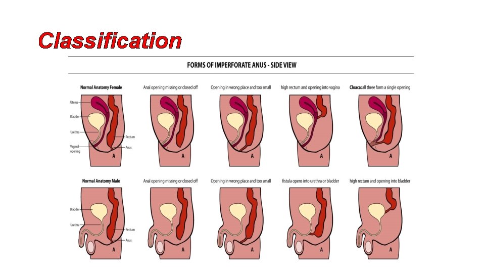 Classification 