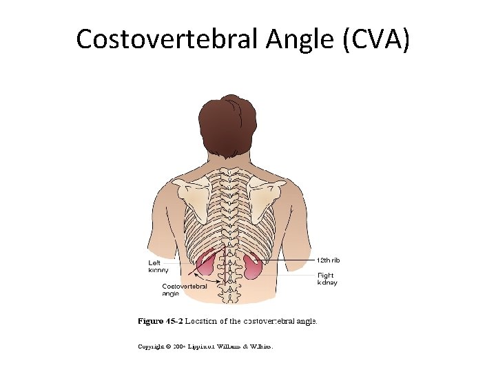 Costovertebral Angle (CVA) 