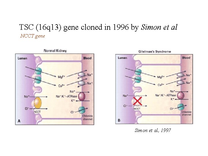 TSC (16 q 13) gene cloned in 1996 by Simon et al NCCT gene