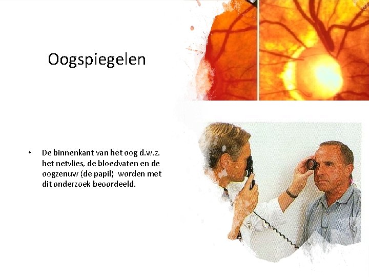 Oogspiegelen • De binnenkant van het oog d. w. z. het netvlies, de bloedvaten