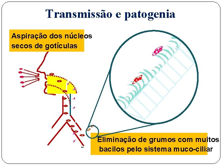 Transmissão e patogenia Aspiração dos núcleos secos de gotículas Eliminação de grumos com muitos