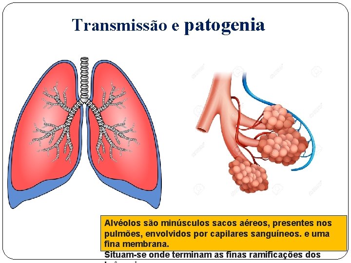 Transmissão e patogenia Alvéolos são minúsculos sacos aéreos, presentes nos pulmões, envolvidos por capilares
