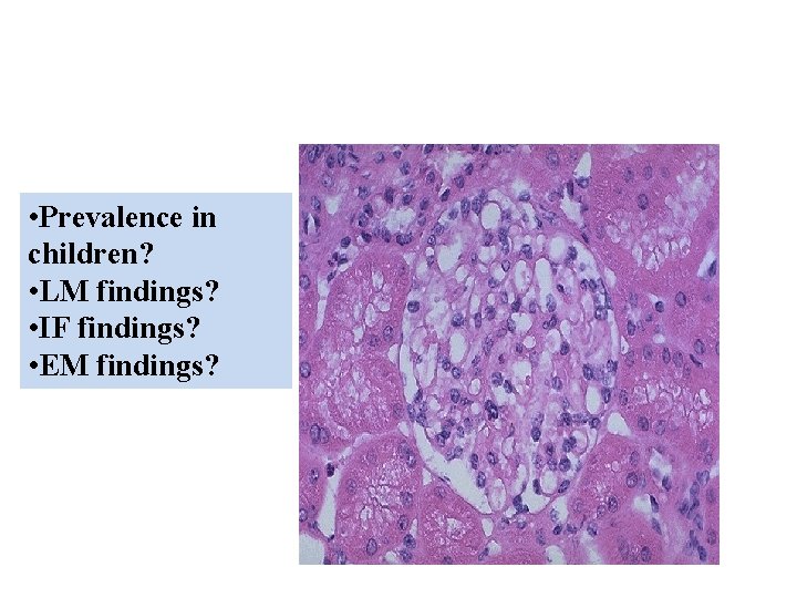  • Prevalence in children? • LM findings? • IF findings? • EM findings?