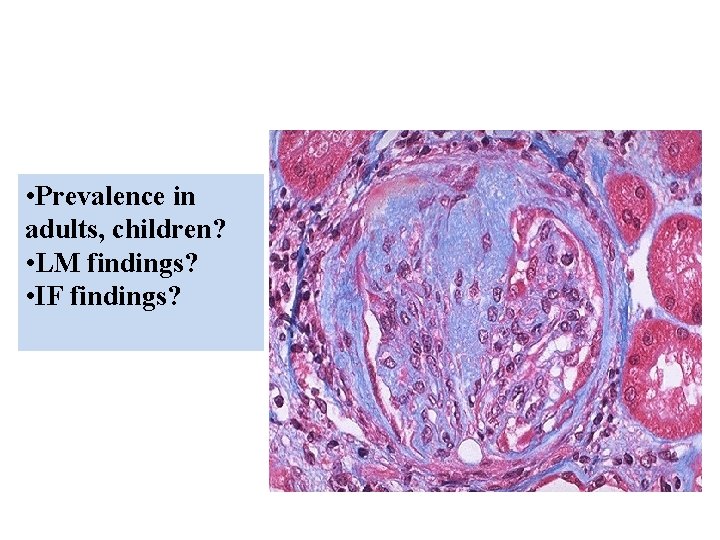  • Prevalence in adults, children? • LM findings? • IF findings? 