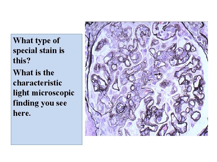 What type of special stain is this? What is the characteristic light microscopic finding