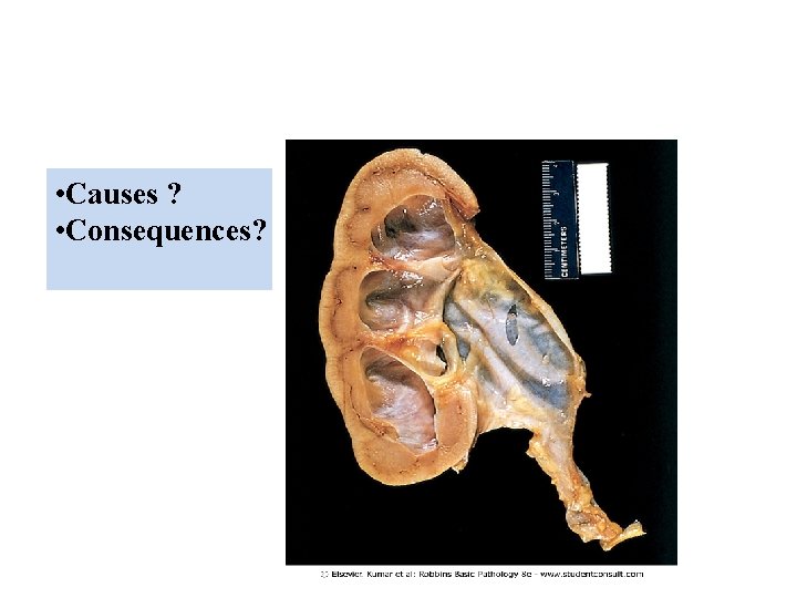  • Causes ? • Consequences? 