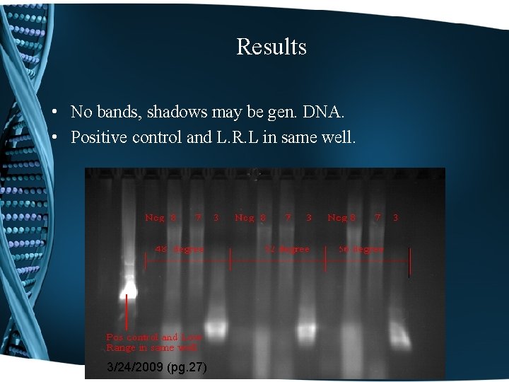 Results • No bands, shadows may be gen. DNA. • Positive control and L.