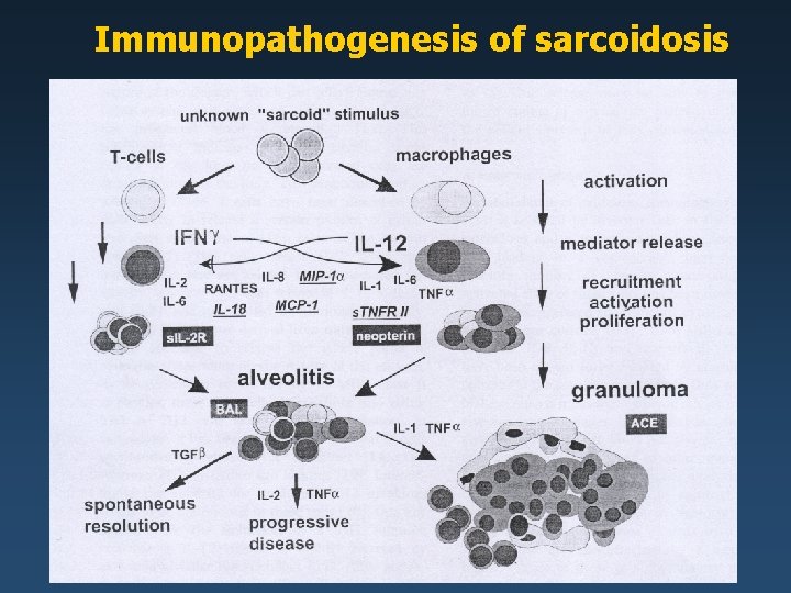 Immunopathogenesis of sarcoidosis 