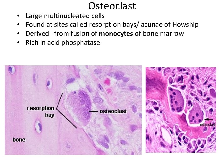 • • Osteoclast Large multinucleated cells Found at sites called resorption bays/lacunae of • • Osteoclast Large multinucleated cells Found at sites called resorption bays/lacunae of