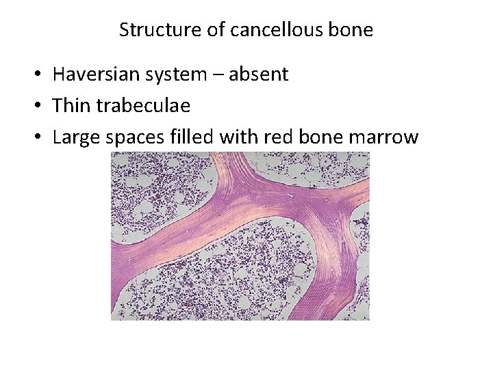 Structure of cancellous bone • Haversian system – absent • Thin trabeculae • Large Structure of cancellous bone • Haversian system – absent • Thin trabeculae • Large