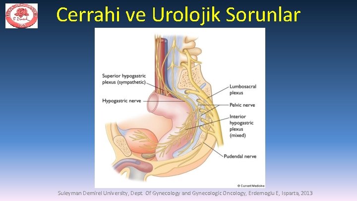 Cerrahi ve Urolojik Sorunlar Suleyman Demirel University, Dept. Of Gynecology and Gynecologic Oncology, Erdemoglu