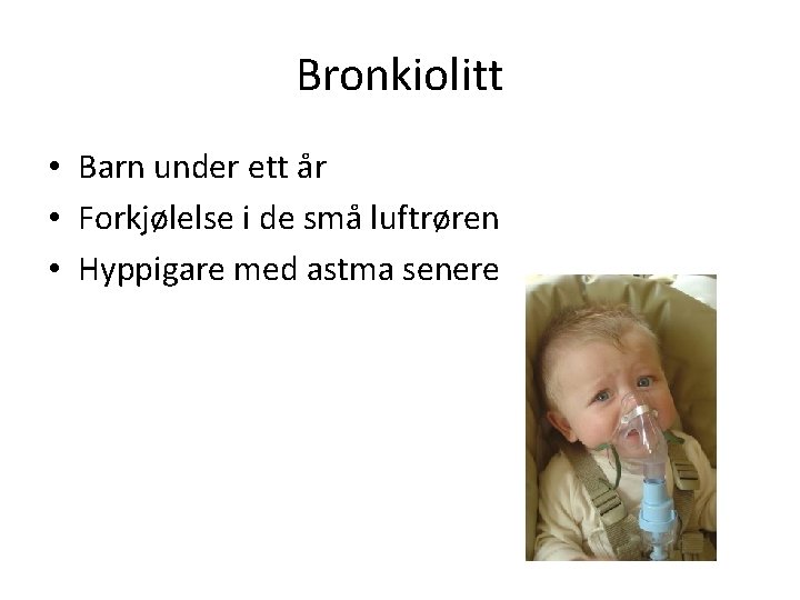 Bronkiolitt • Barn under ett år • Forkjølelse i de små luftrøren • Hyppigare