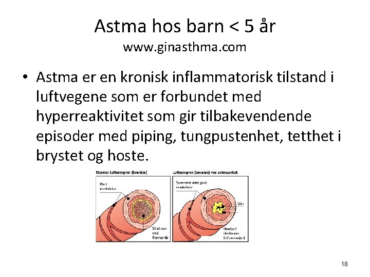 Astma hos barn < 5 år www. ginasthma. com • Astma er en kronisk