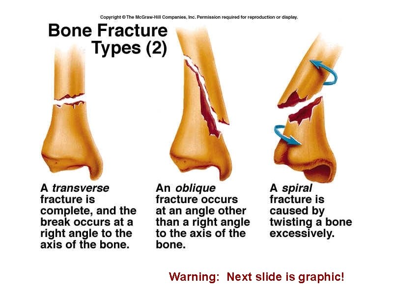 Warning: Next slide is graphic! 
