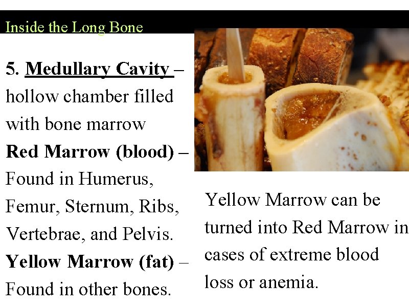 Inside the Long Bone 5. Medullary Cavity – hollow chamber filled with bone marrow