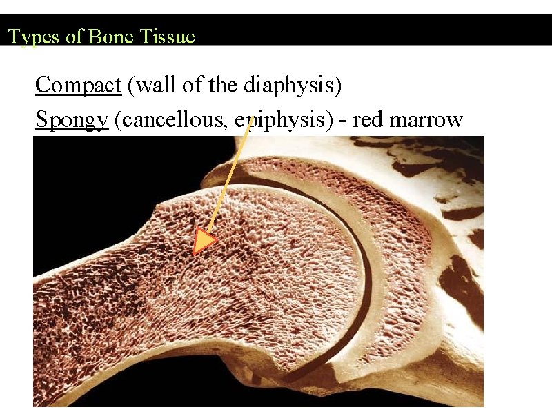 Types of Bone Tissue Compact (wall of the diaphysis) Spongy (cancellous, epiphysis) - red