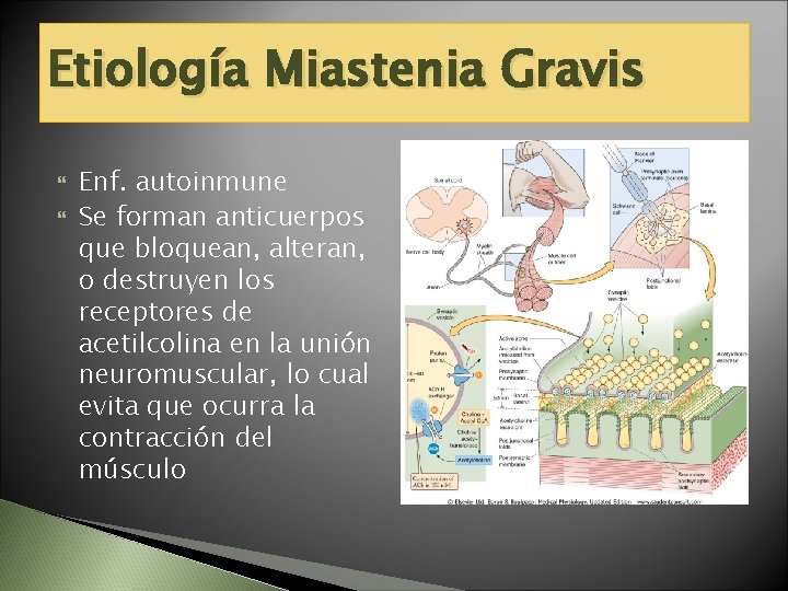 Etiología Miastenia Gravis Enf. autoinmune Se forman anticuerpos que bloquean, alteran, o destruyen los