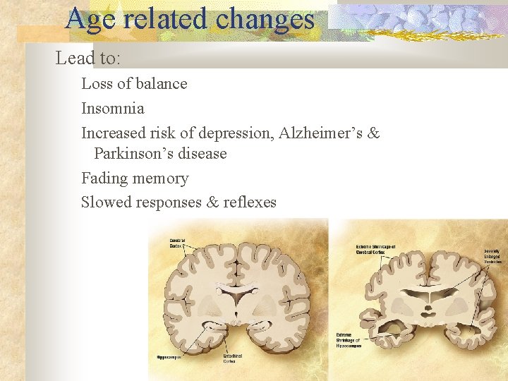 Age related changes Lead to: Loss of balance Insomnia Increased risk of depression, Alzheimer’s