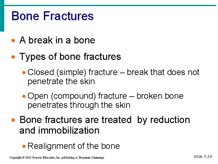 Bone Fractures · A break in a bone · Types of bone fractures ·