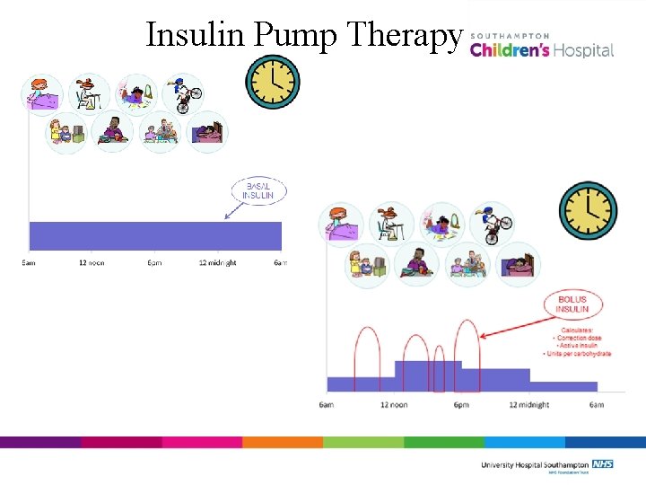 Insulin Pump Therapy 