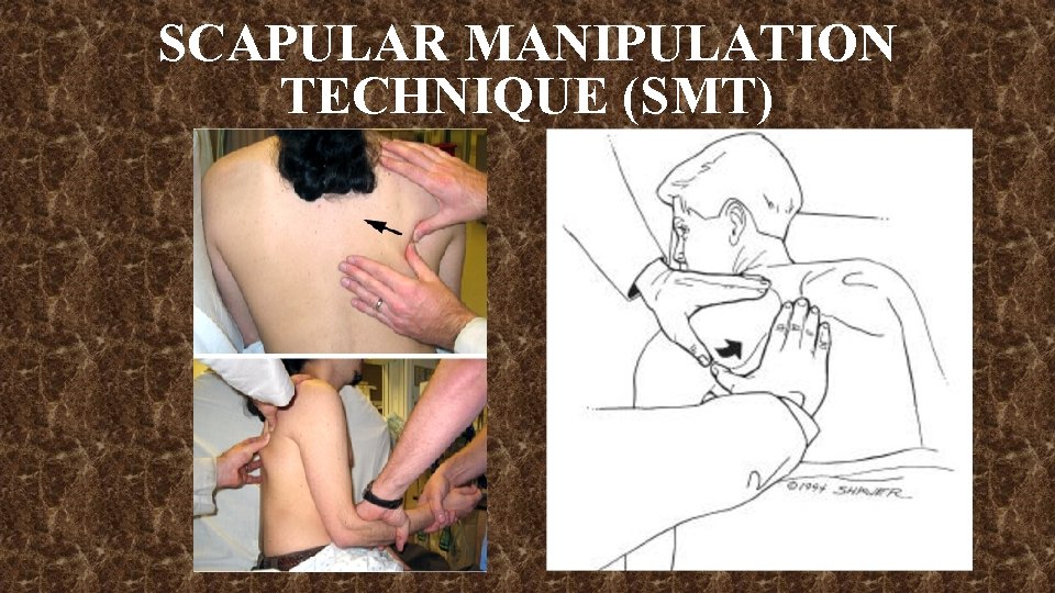 SCAPULAR MANIPULATION TECHNIQUE (SMT) 