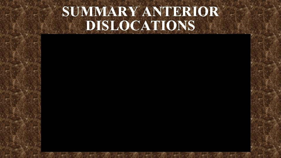 SUMMARY ANTERIOR DISLOCATIONS 