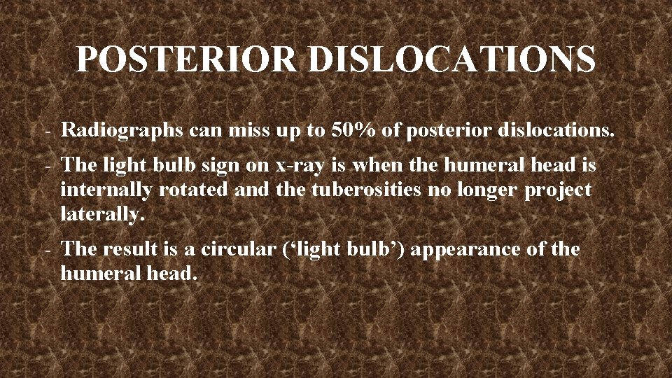 POSTERIOR DISLOCATIONS - Radiographs can miss up to 50% of posterior dislocations. - The