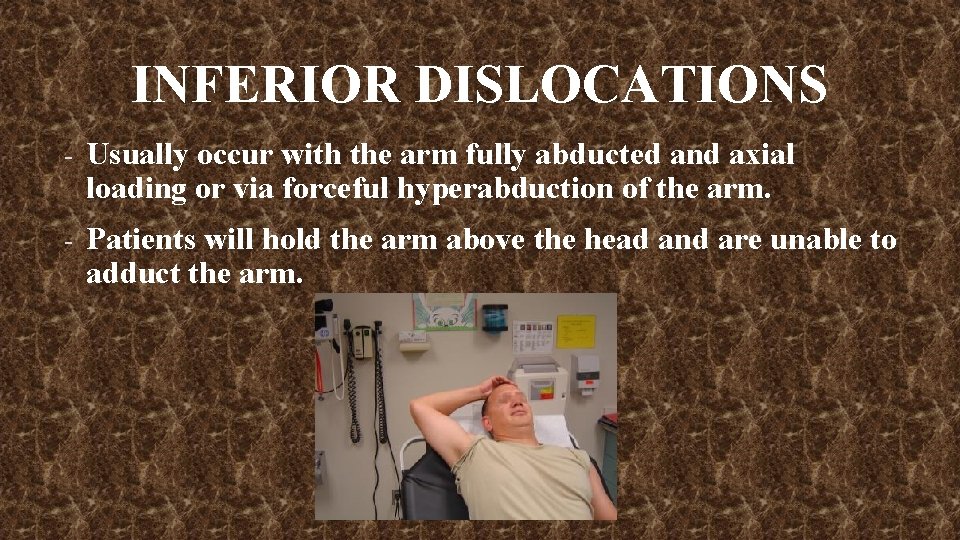 INFERIOR DISLOCATIONS - Usually occur with the arm fully abducted and axial loading or