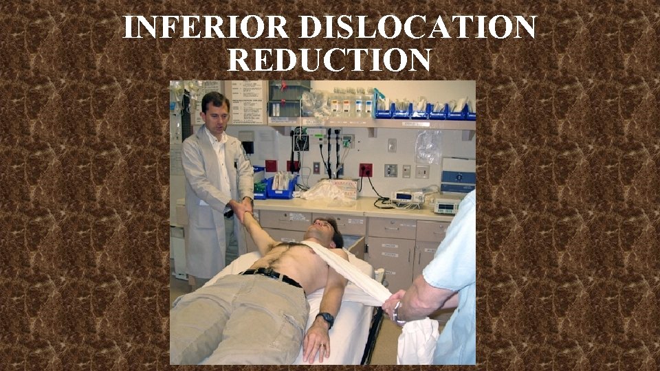 INFERIOR DISLOCATION REDUCTION 