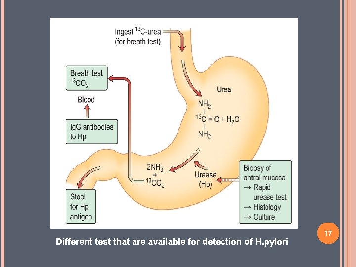 Different test that are available for detection of H. pylori 17 