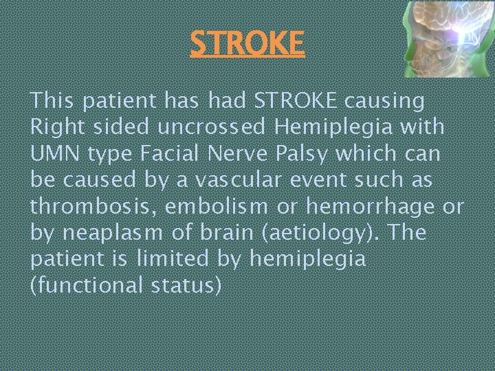 STROKE This patient has had STROKE causing Right sided uncrossed Hemiplegia with UMN type
