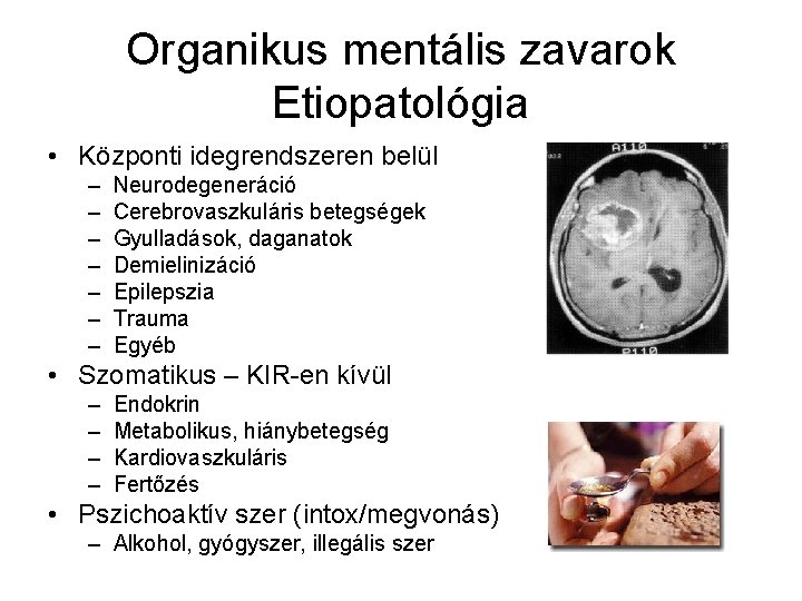 Organikus mentális zavarok Etiopatológia • Központi idegrendszeren belül – – – – Neurodegeneráció Cerebrovaszkuláris