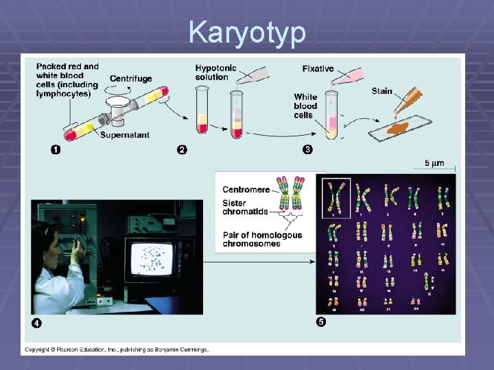 Karyotyp 