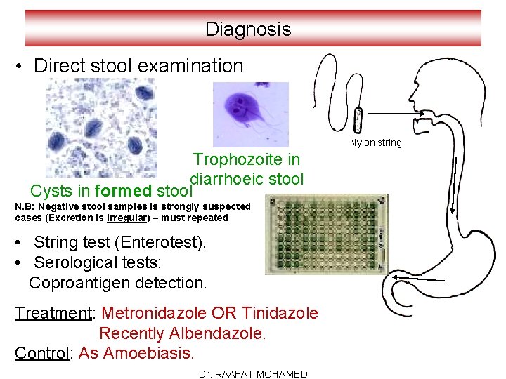 Diagnosis • Direct stool examination Nylon string Trophozoite in diarrhoeic stool Cysts in formed