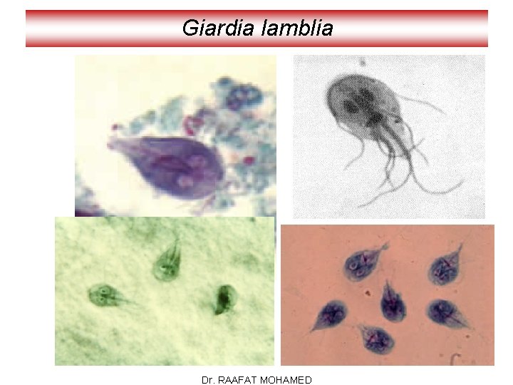 Giardia lamblia Dr. RAAFAT MOHAMED 