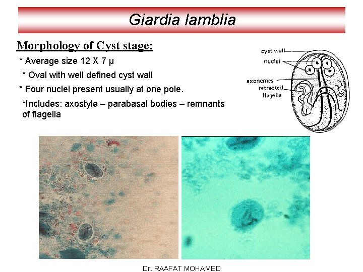 Giardia lamblia Morphology of Cyst stage: * Average size 12 X 7 µ *