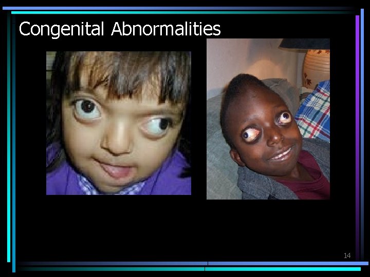 Congenital Abnormalities 14 