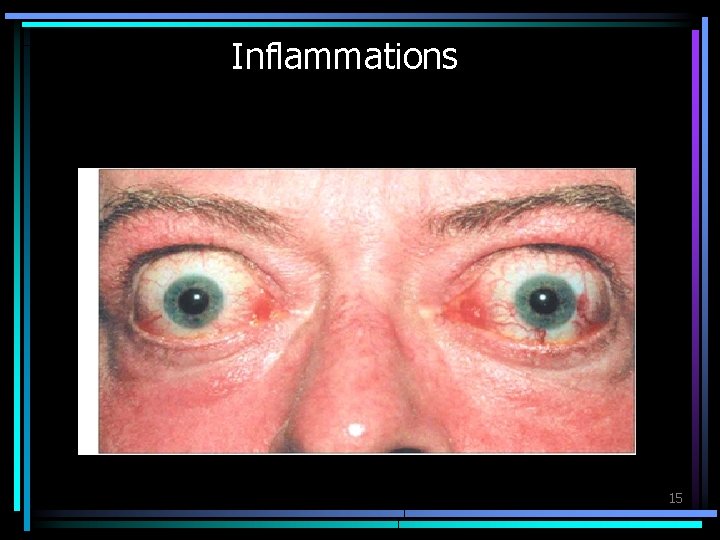 Inflammations 15 