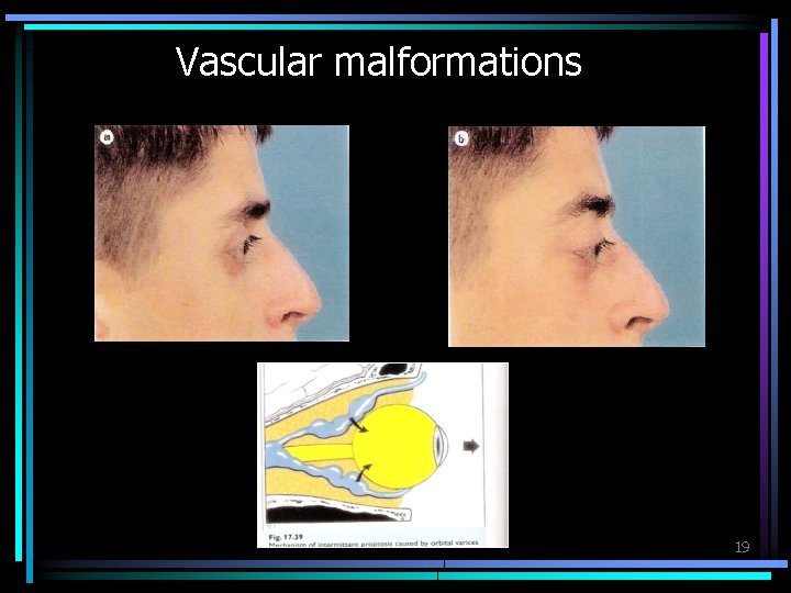 Vascular malformations 19 