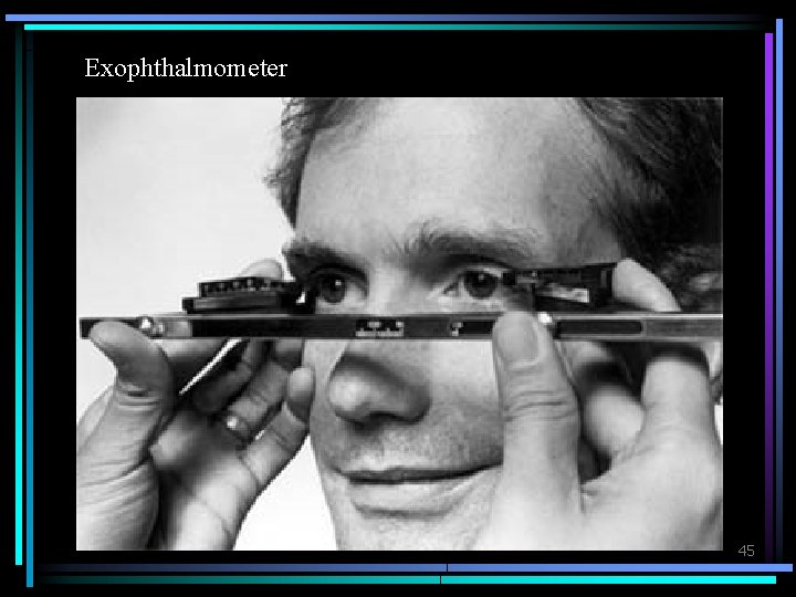 Exophthalmometer 45 